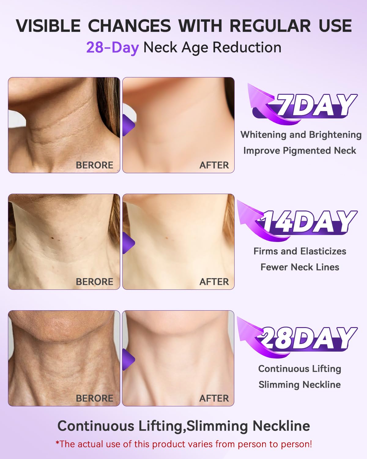 Texture detail of Loviton advanced anti aging hydrating cream formula