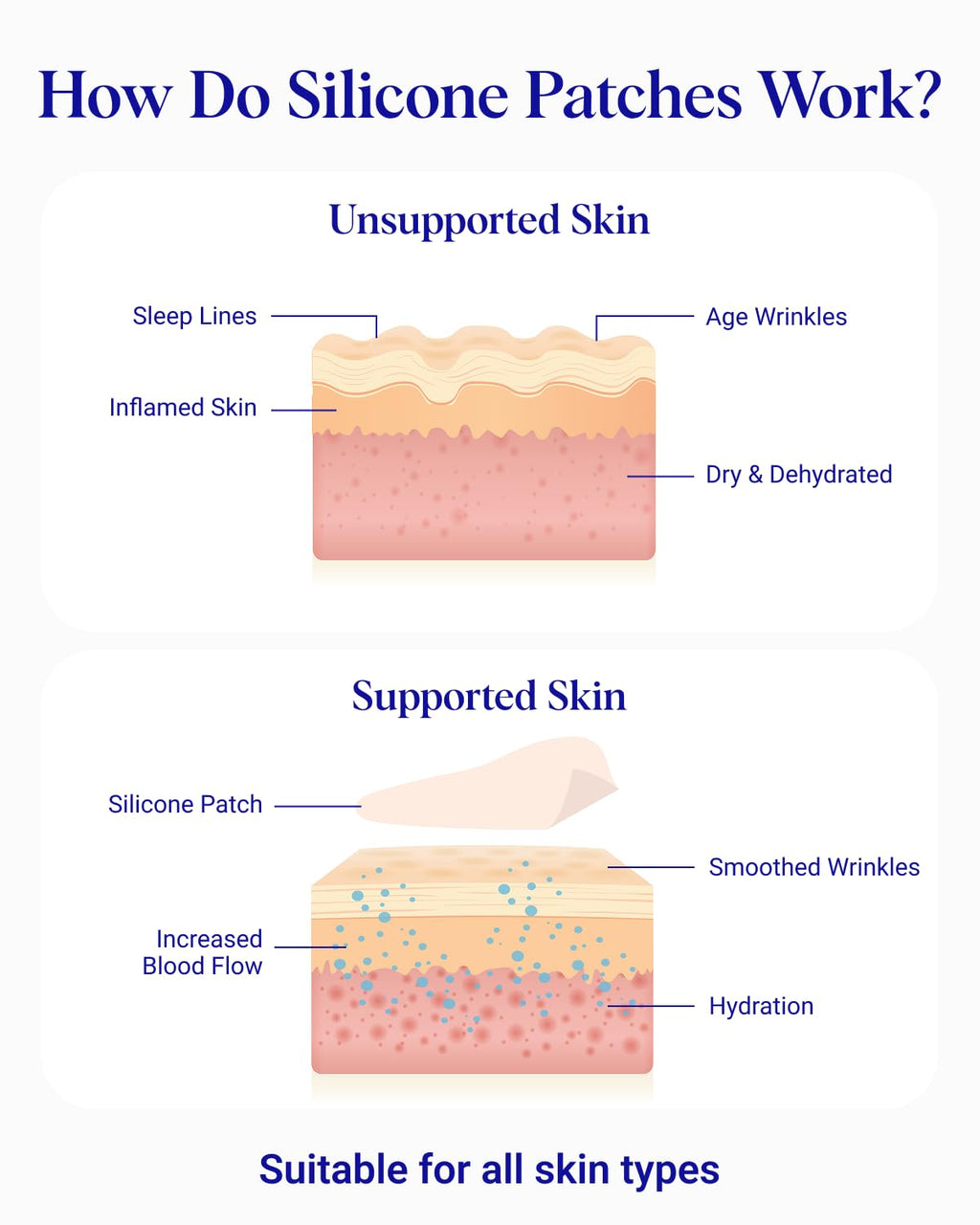 Demonstration of neck wrinkle patch applied on the neck