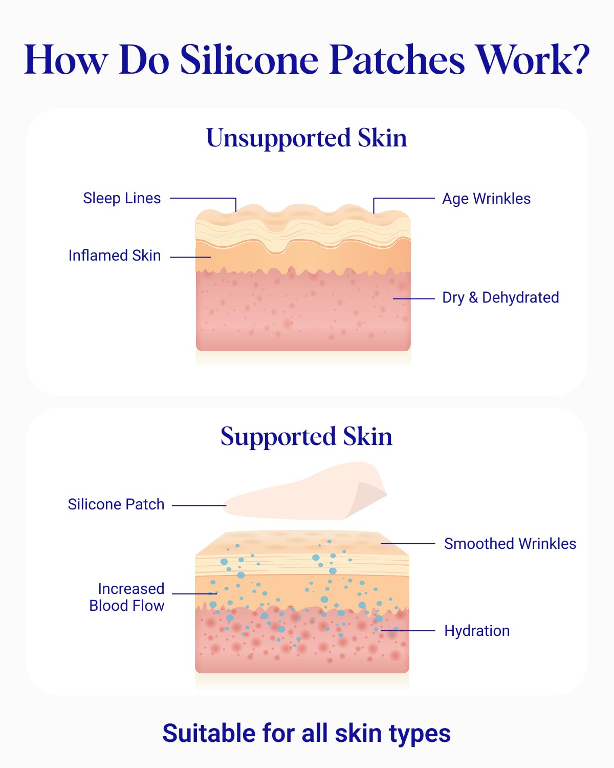 Wrinkles Schminkles neck patch removed from packaging