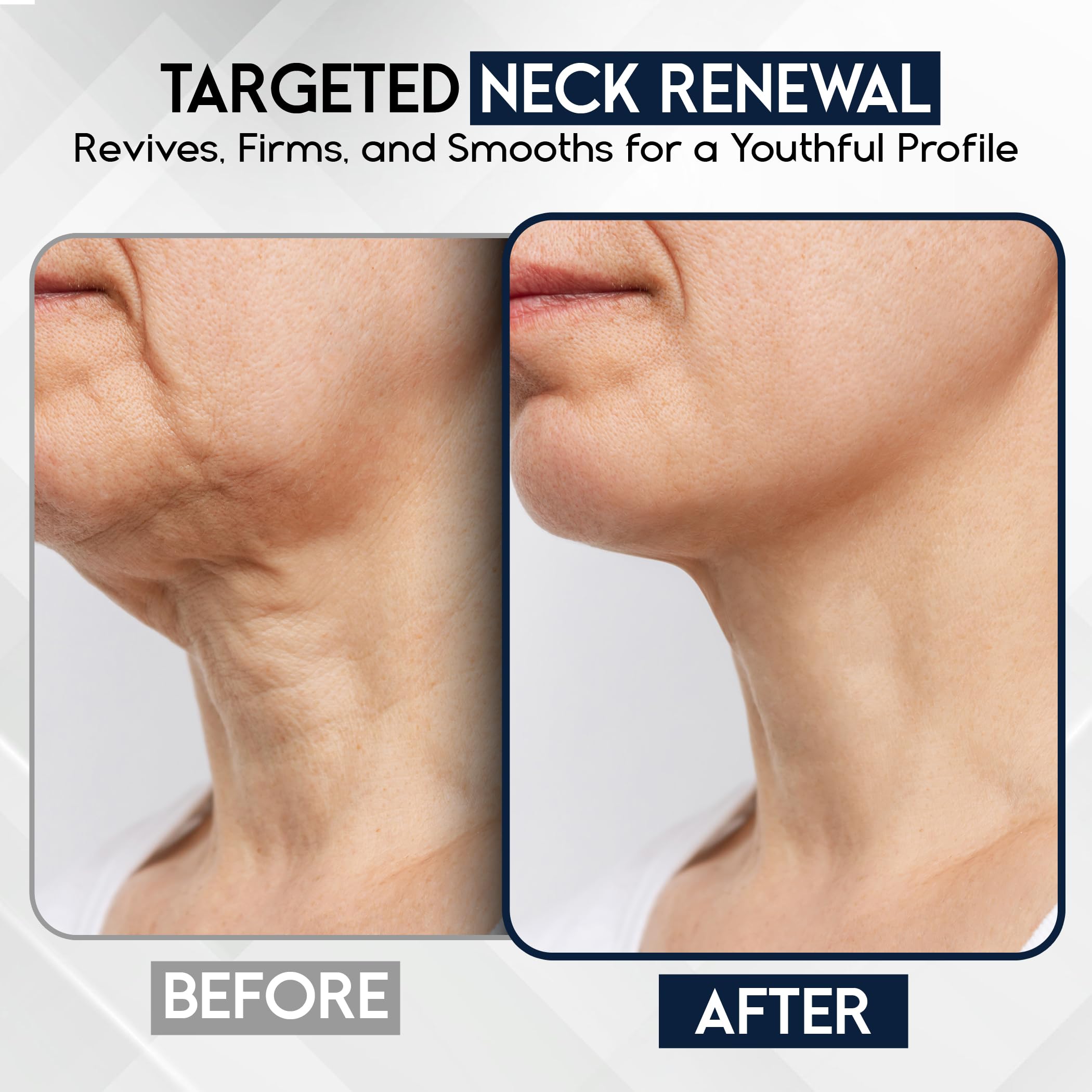 Texture of Pharmlitalia anti-aging neck and decollete cream