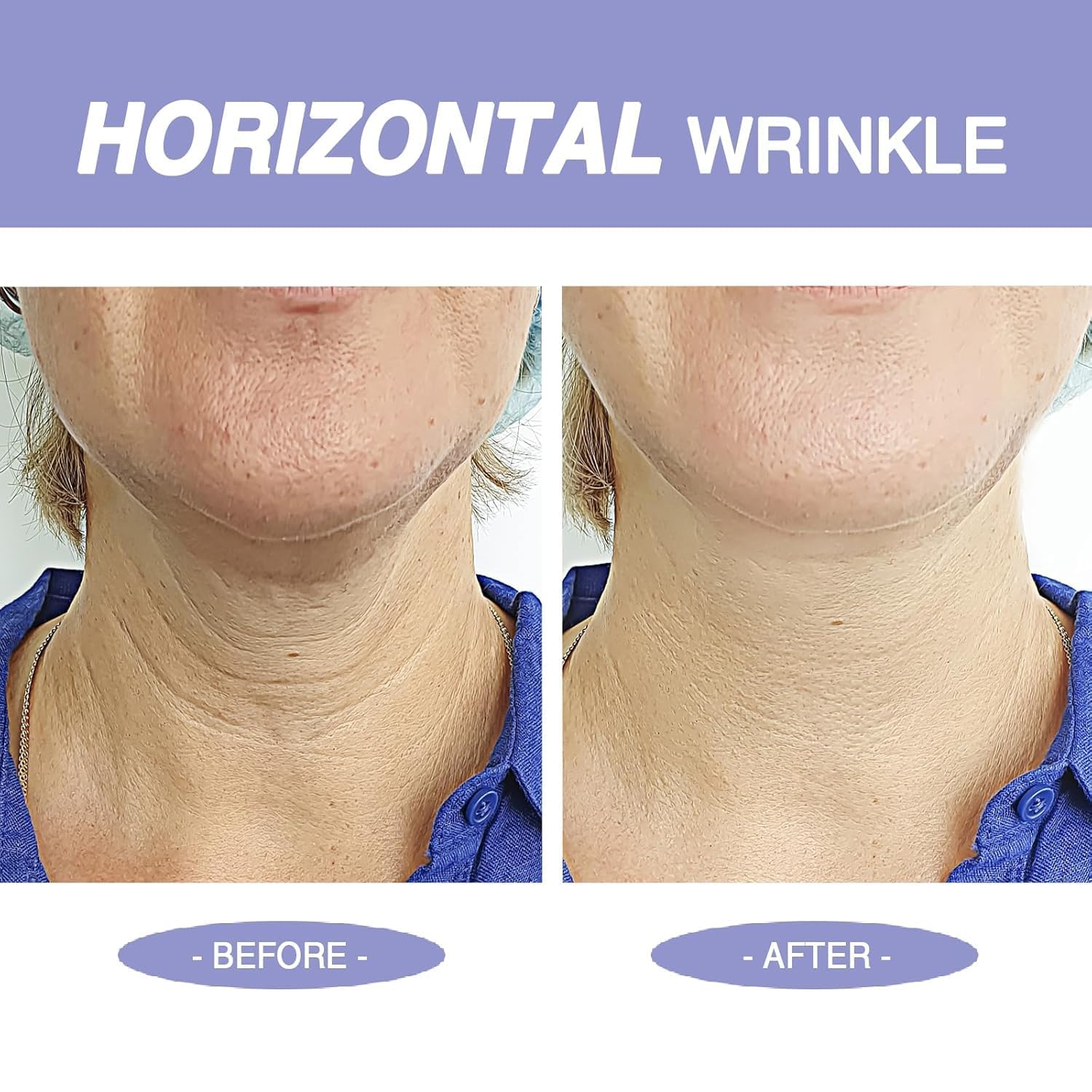 StriVectin anti aging skin tightening cream for face neck and chest overview.