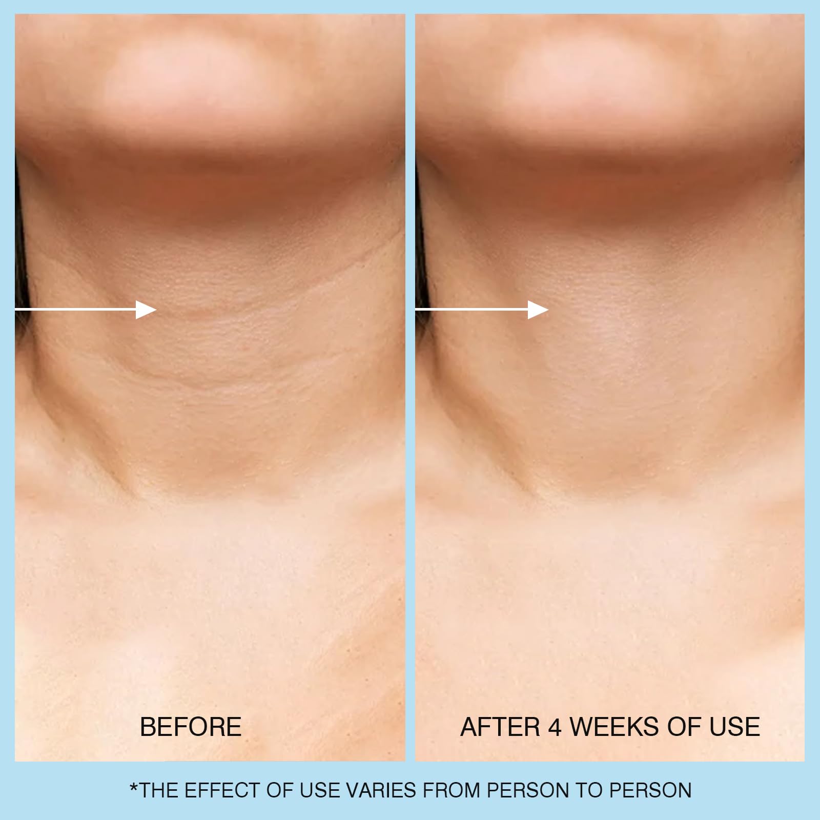 UJhay skincare product packaging detailing directions for minimizing sagging skin.