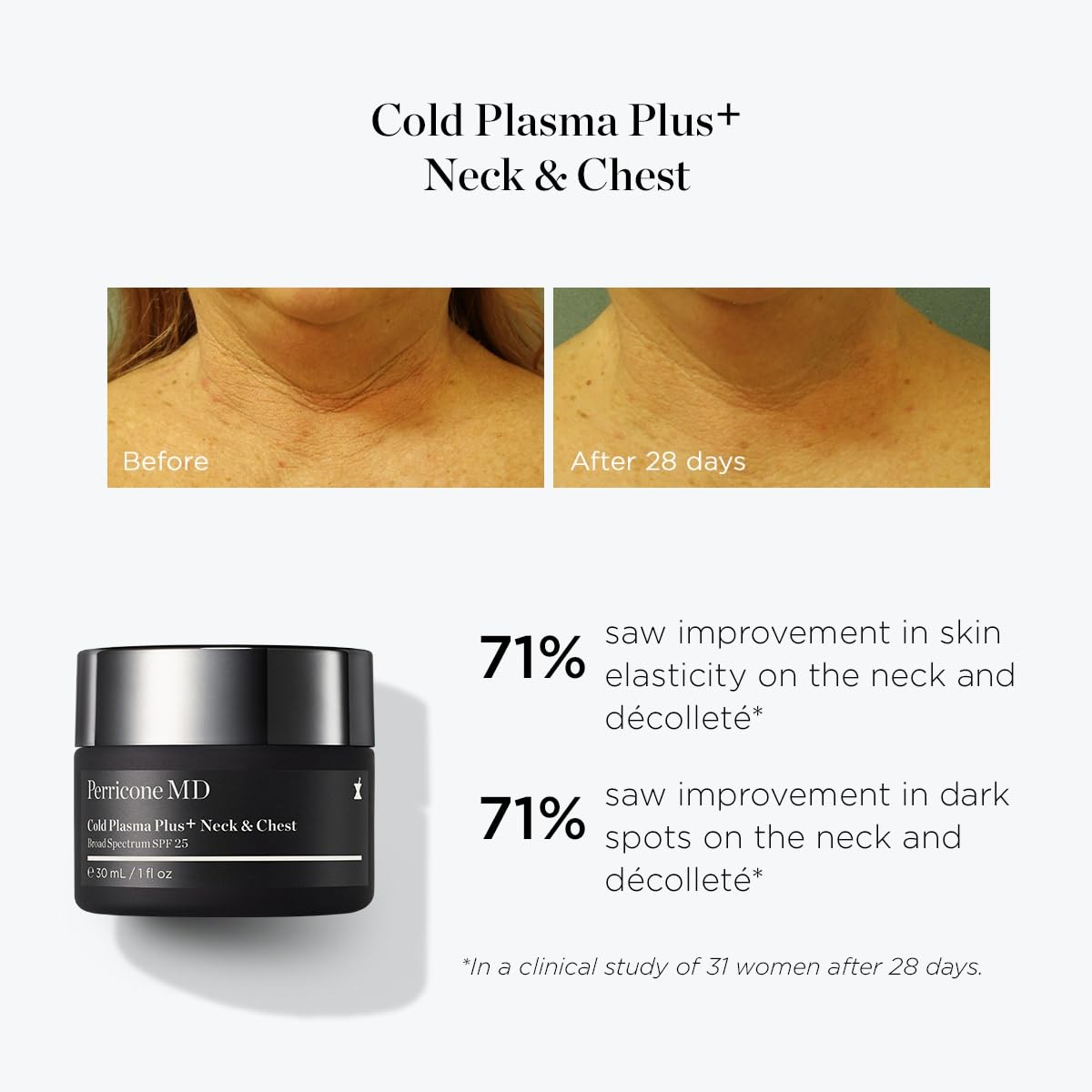 Whipped texture of Perricone MD Cold Plasma Plus+ neck cream