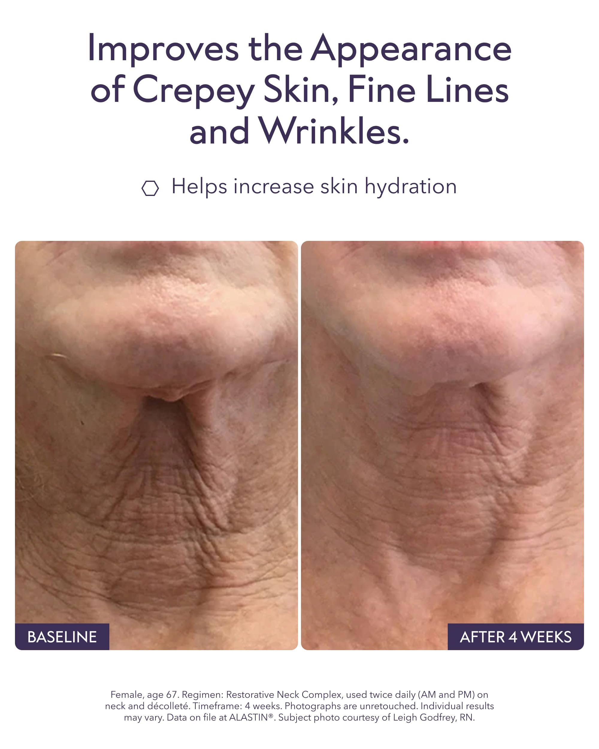 Authentic USA imported Alastin neck cream product detail