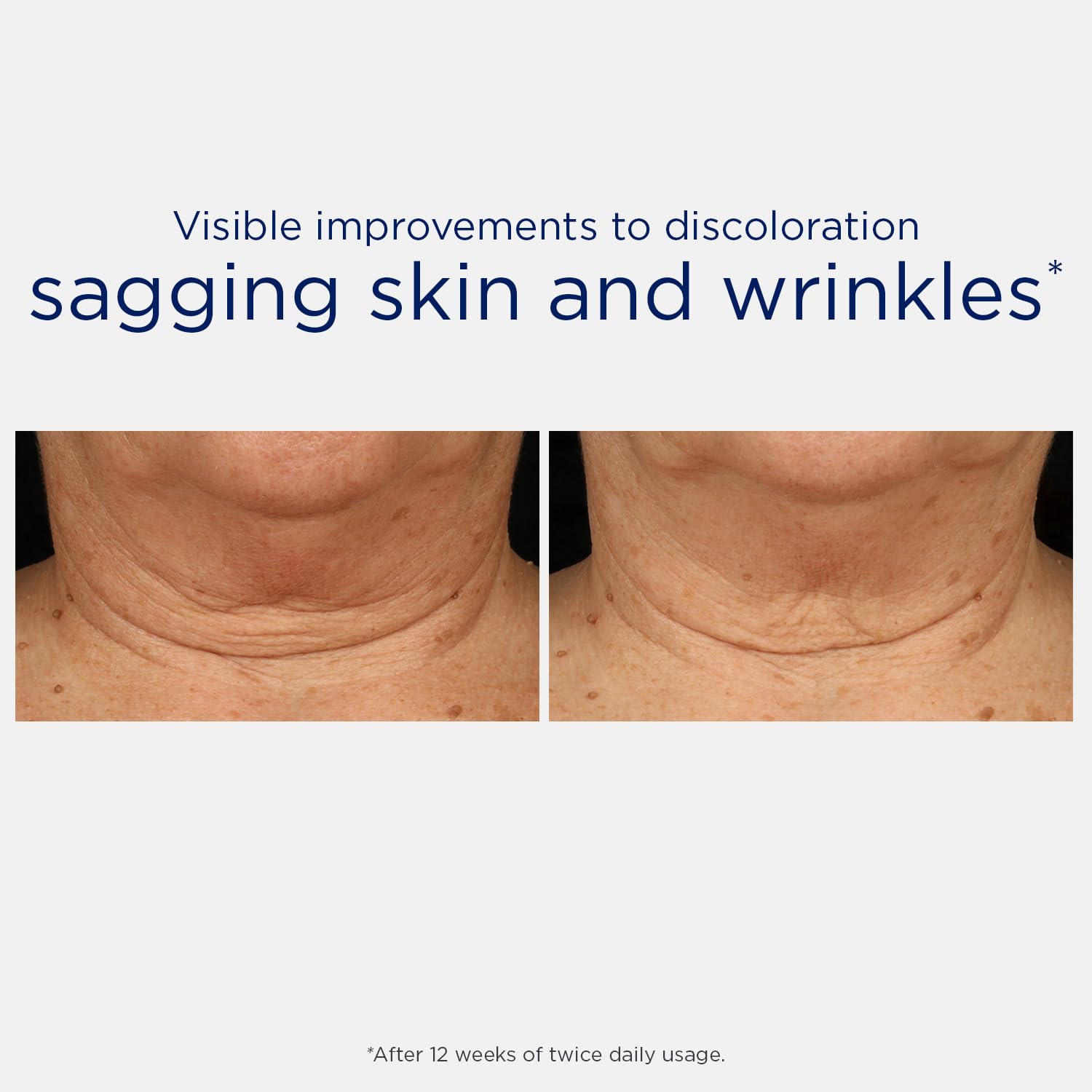 Detailed view of Neostrata Triple Firming Neck Cream label