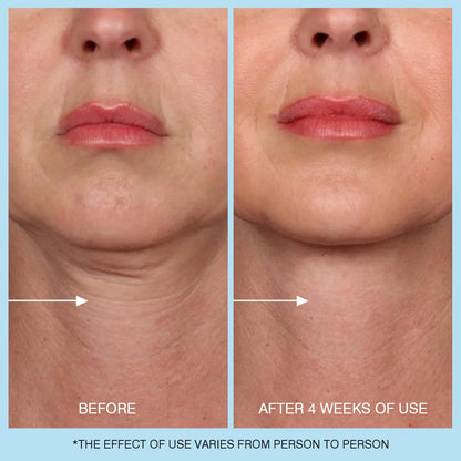 Ujhay 3-in-1 face neck and chest firming cream