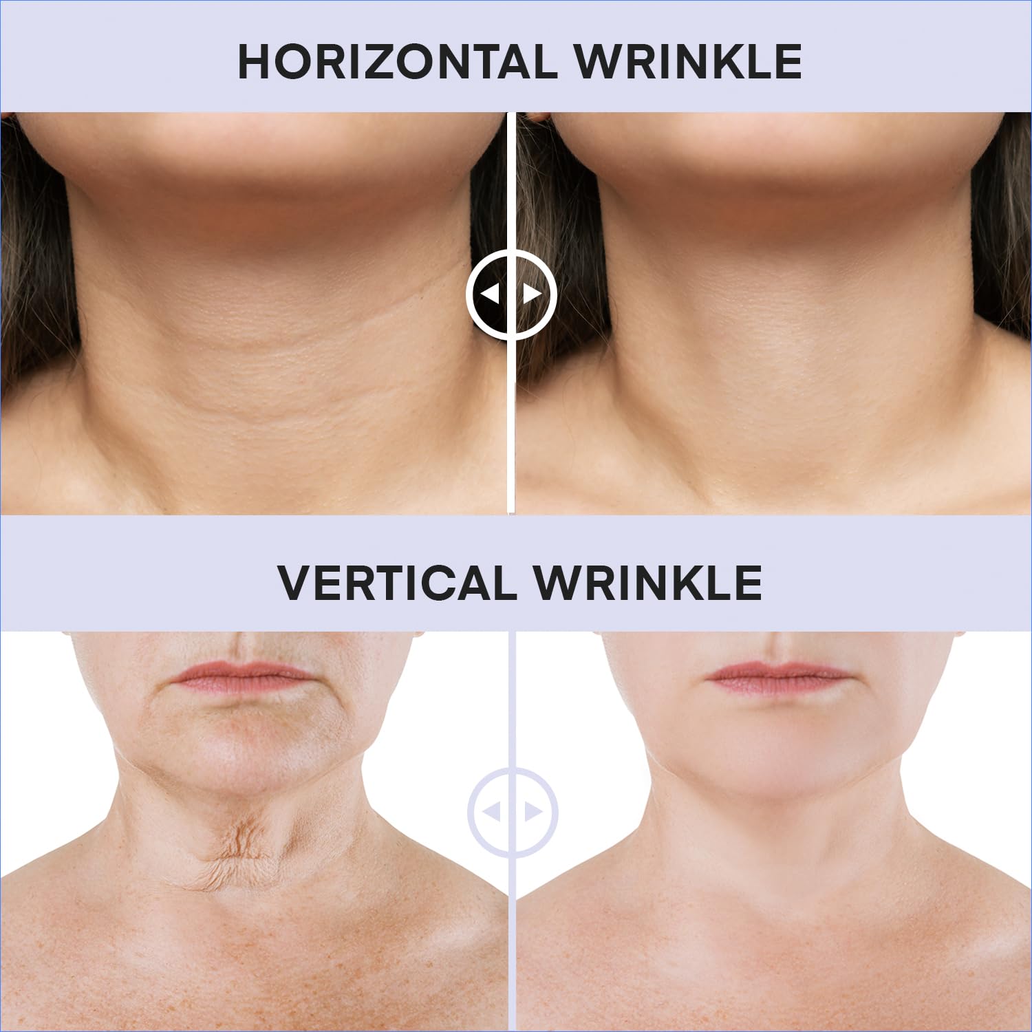 Derphea skincare product label showing ingredients and benefits