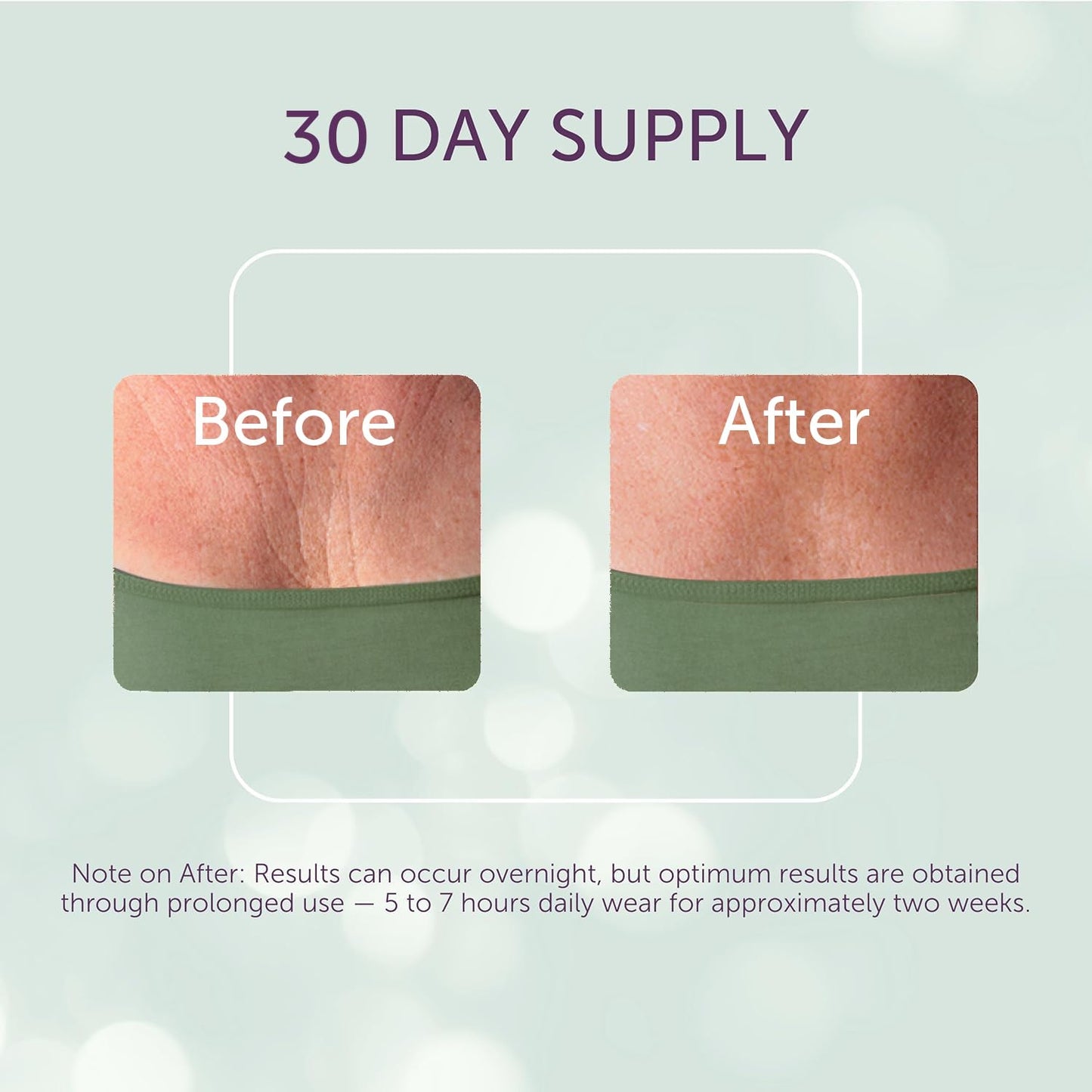Silc Skin chest wrinkle treatment packaging front view