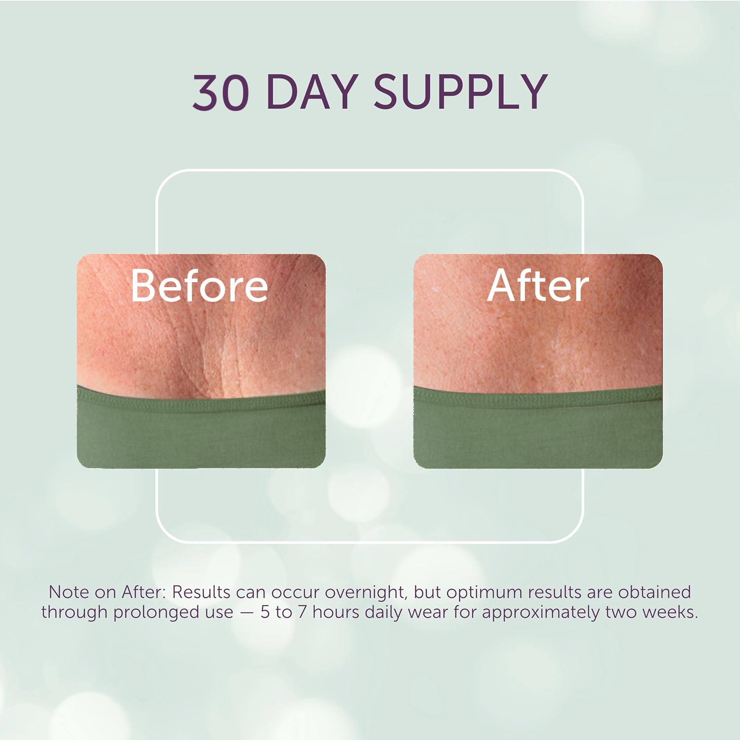 Silc Skin chest wrinkle treatment packaging front view