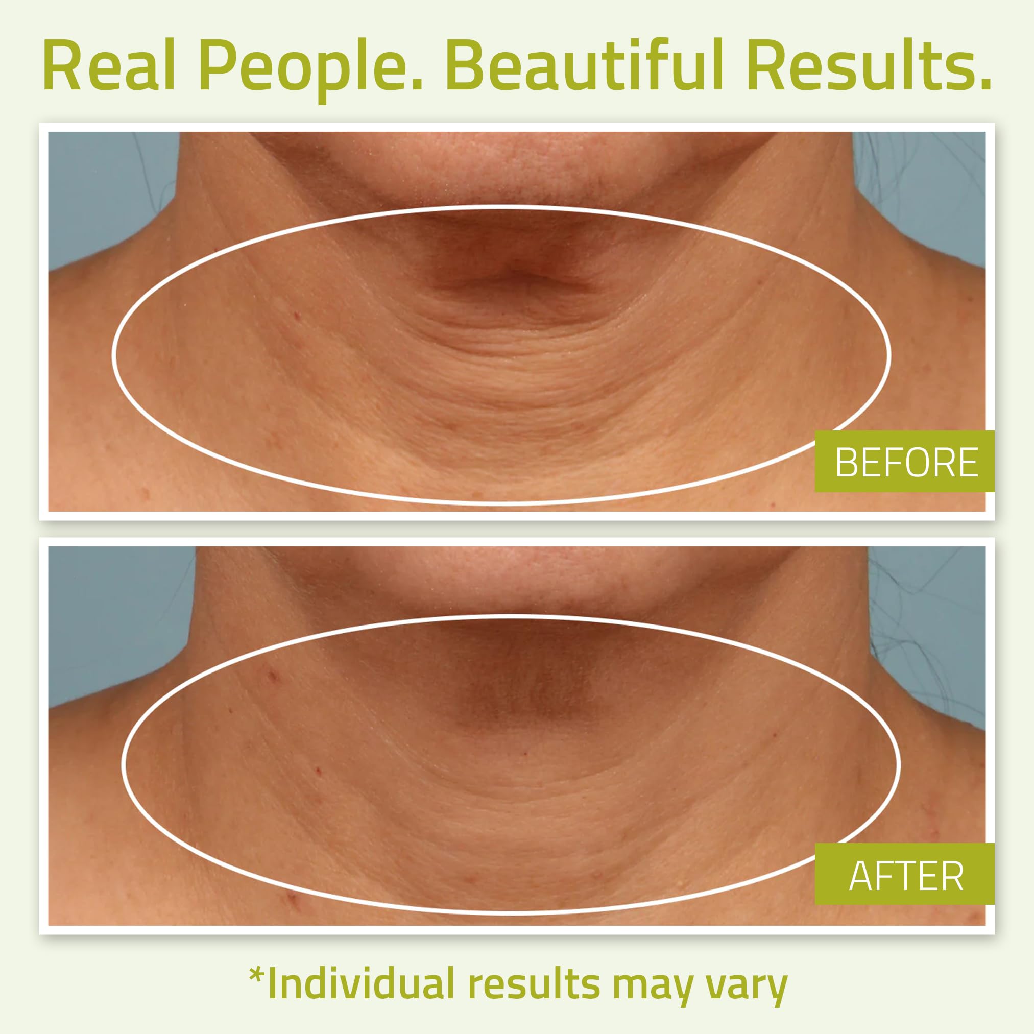 Yeouth skin firming cream texture and consistency demonstration