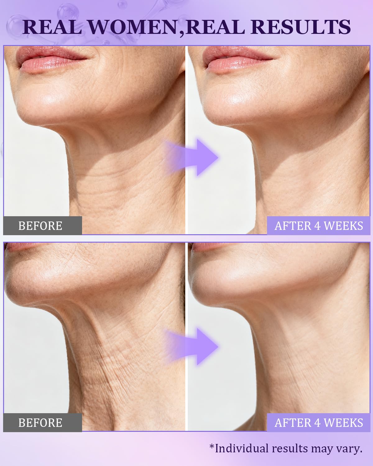 Cheokingba retinol cream for décolleté and neck application