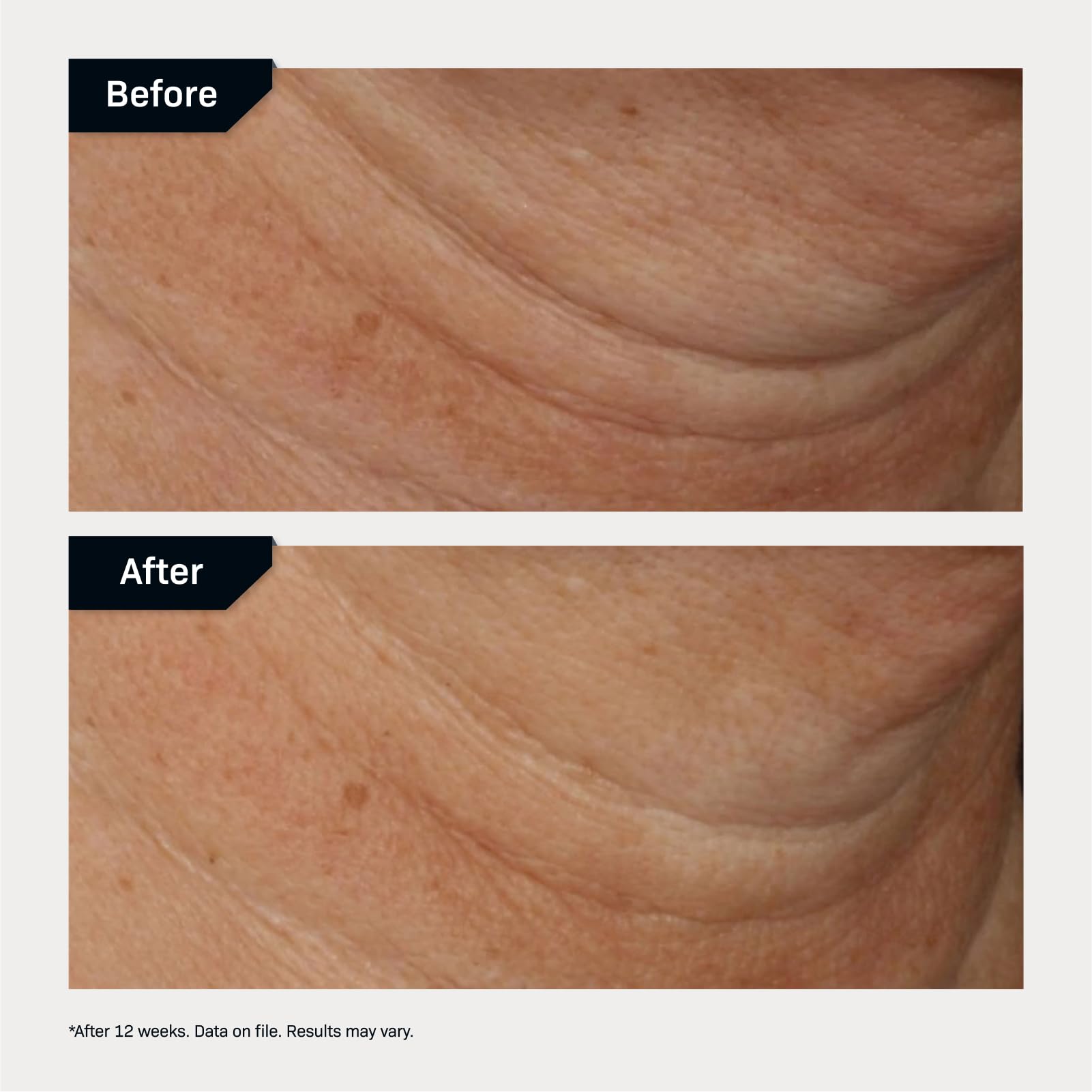 Revision Skincare Nectifirm Advanced bottle back label details