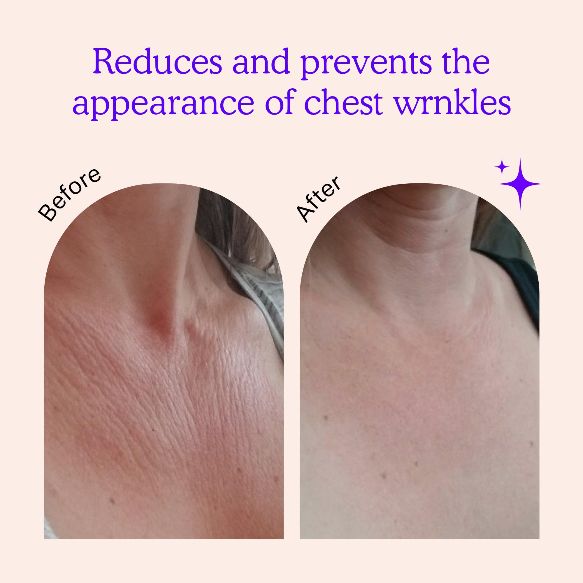 Blumbody reusable silicone chest patches application demonstration