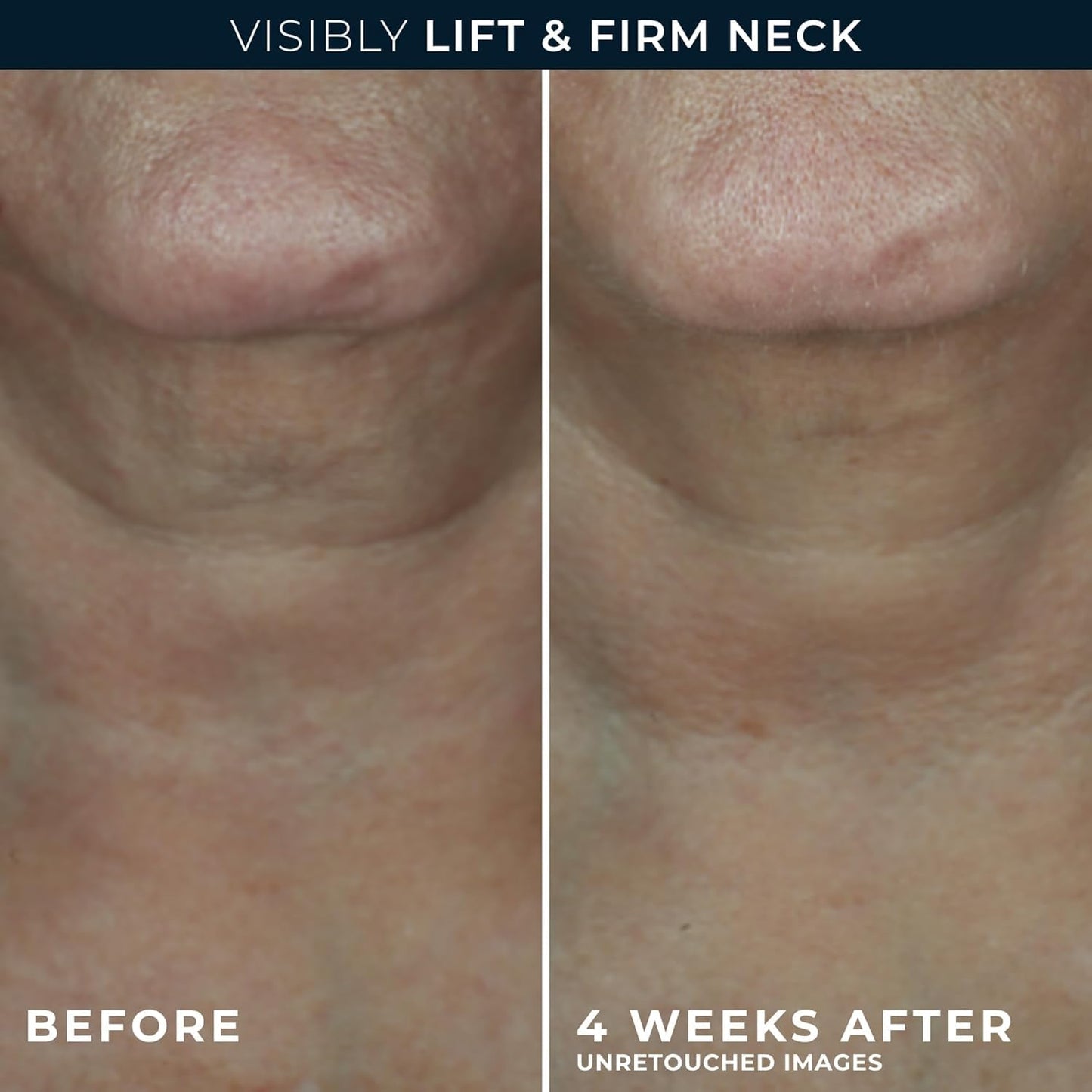 Side profile of RoC Derm Correxion jar showing 1.7 fluid ounce size
