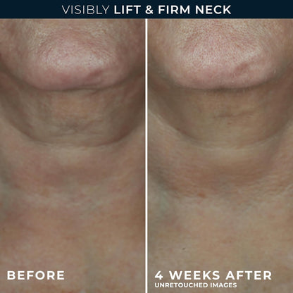 Side profile of RoC Derm Correxion jar showing 1.7 fluid ounce size