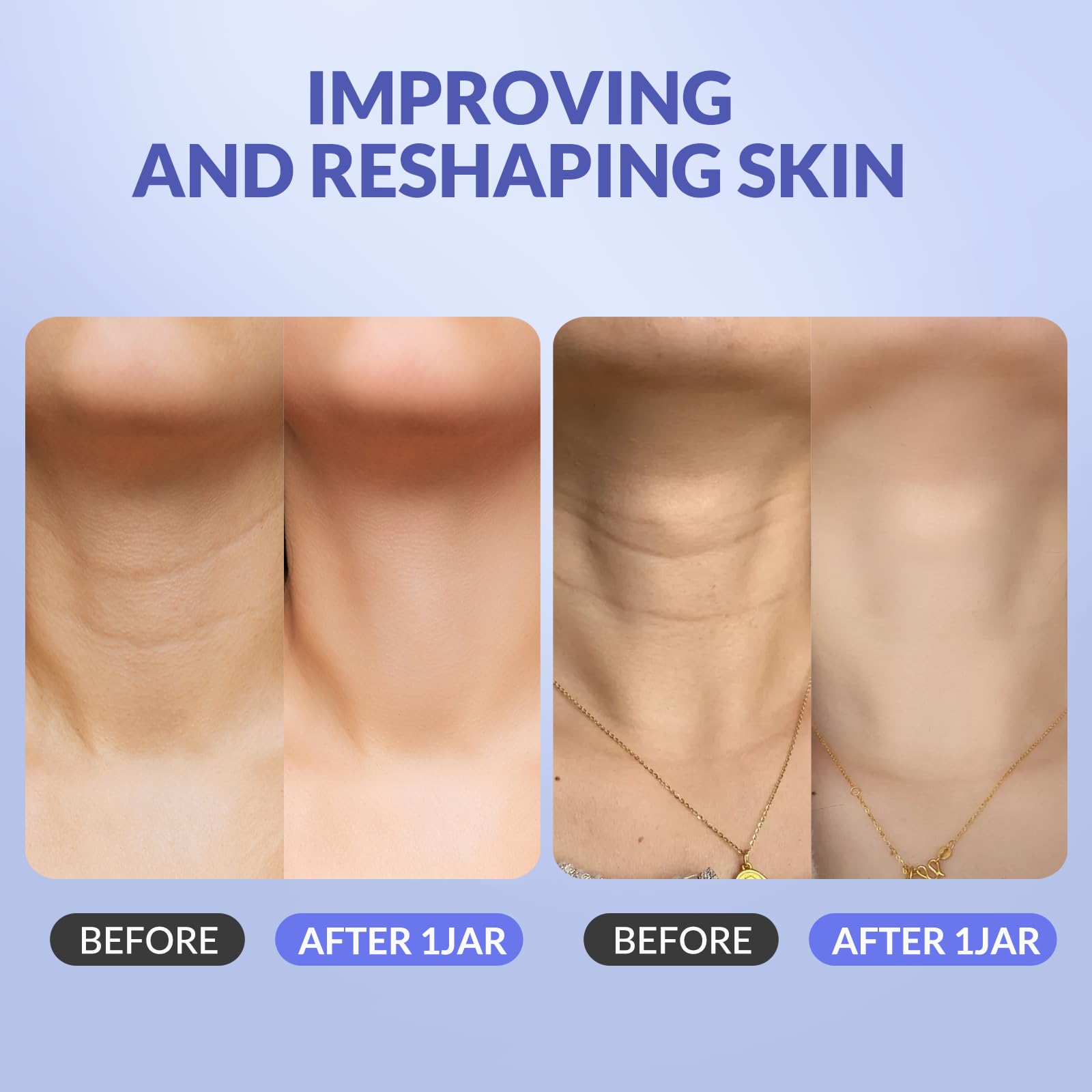 Detailed view of Crogooe neck cream packaging for crepey skin
