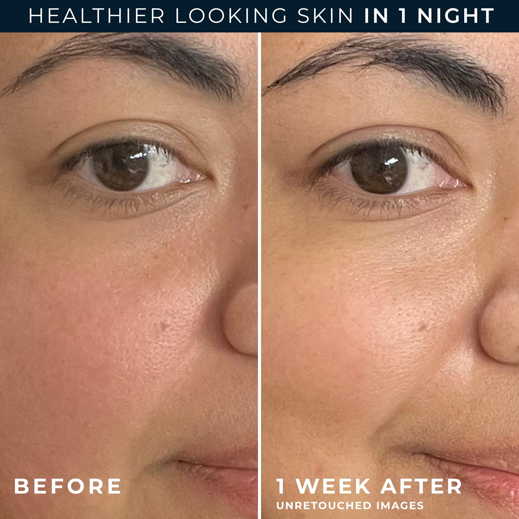 Hypoallergenic night cream by RoC for sensitive skin barrier recovery