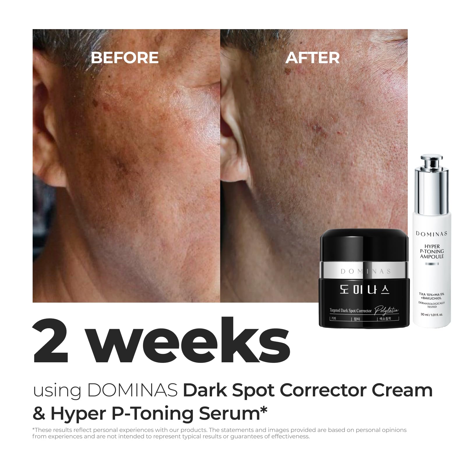 Texture shot of DOMINAS melasma treatment cream showing its rich yet non greasy hydrating formula.