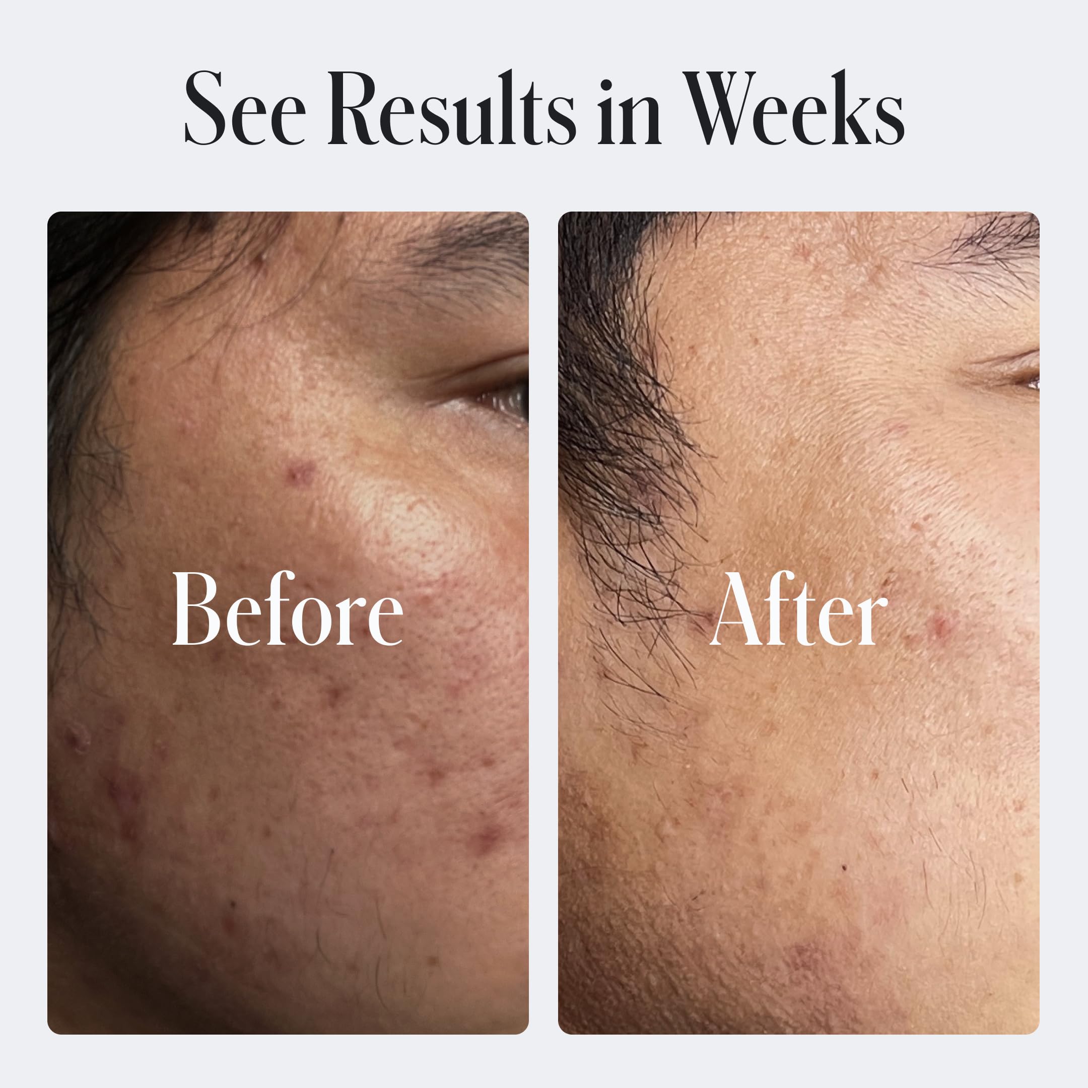Geologie 60ml skincare bottle showing retinol and niacinamide ingredients