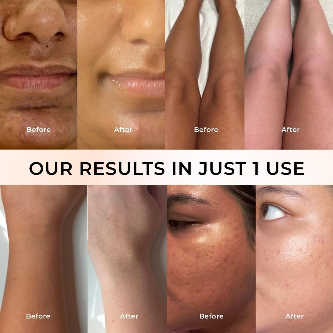 Side profile of Niconi Gluta-Kojic skin polish jar