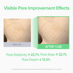 Banila Co Clean It Zero Tea Tree Pore Peeling Gel size and bottle view