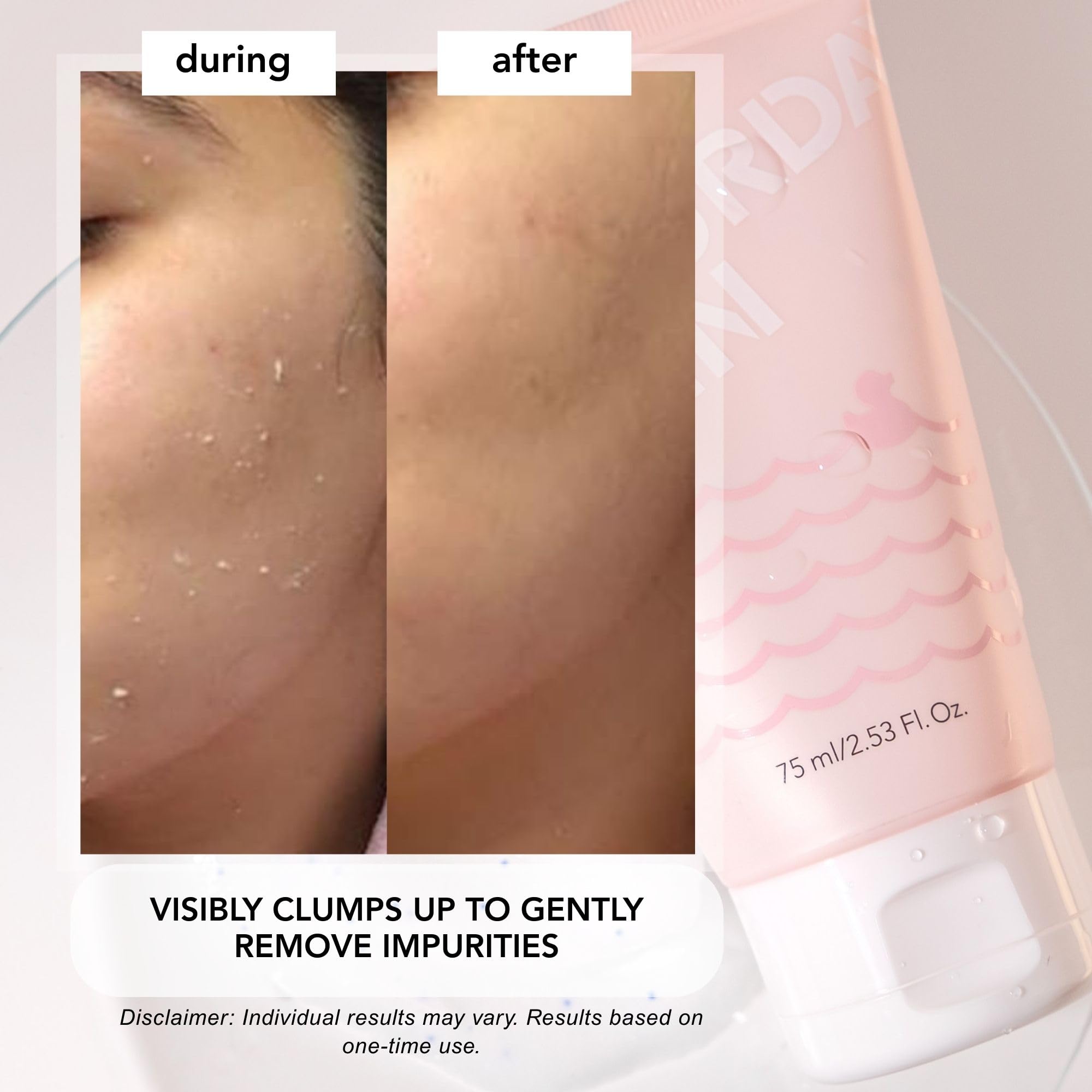 Textural demonstration of the lightweight exfoliating peel gel showing a smooth hybrid cream consistency.
