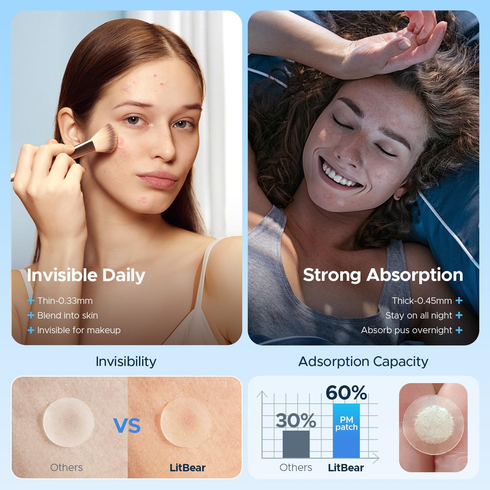 Before and after visual of acne treated with hydrocolloid patches