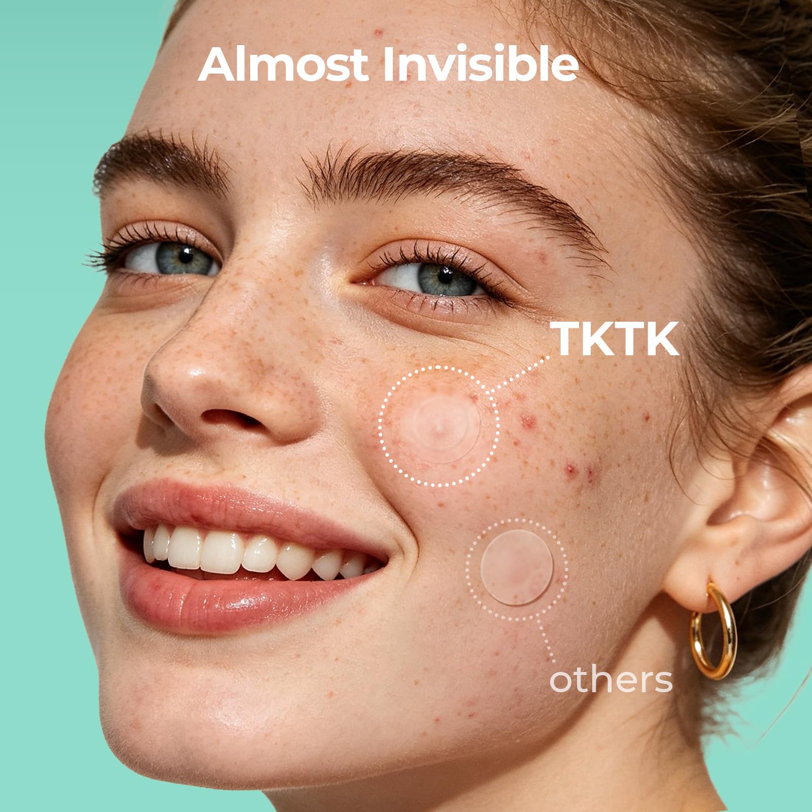TKTK hydrocolloid acne stickers size comparison 10mm and 12mm