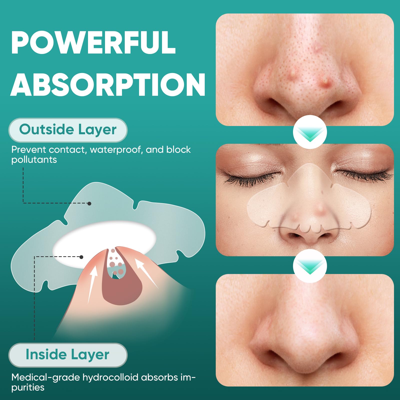 Detailed view of Kindshine pore refining patches for T-zone