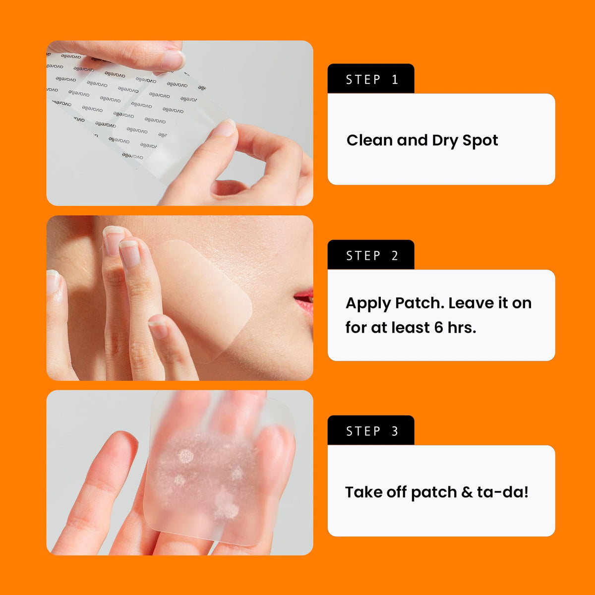 Avarelle acne patch absorbing impurities turning white