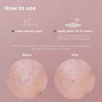 OMMA skincare microdart patch lifestyle product view