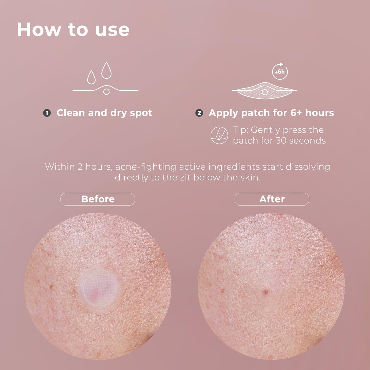 OMMA skincare microdart patch lifestyle product view