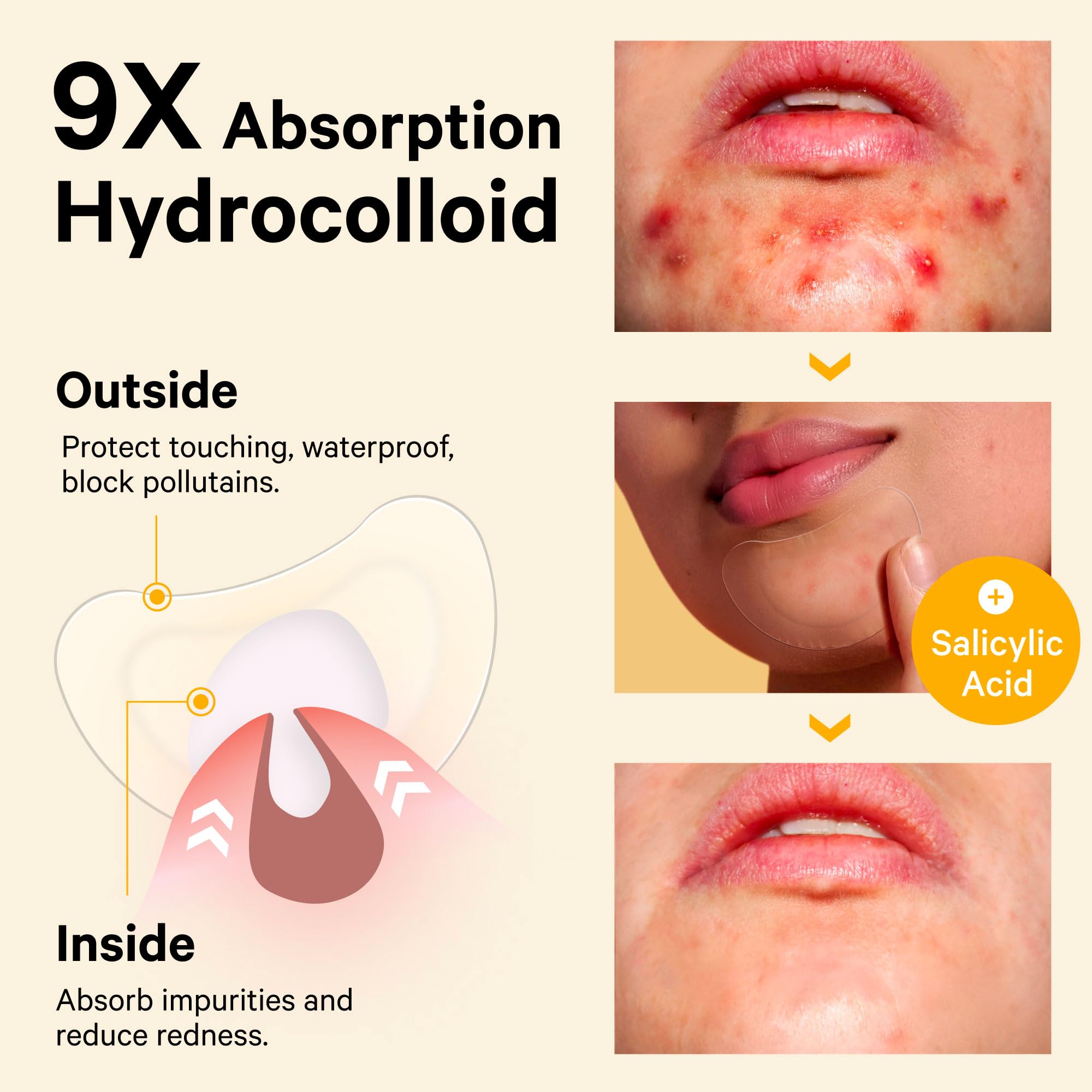 Medical grade hydrocolloid acne patch texture and shape close up