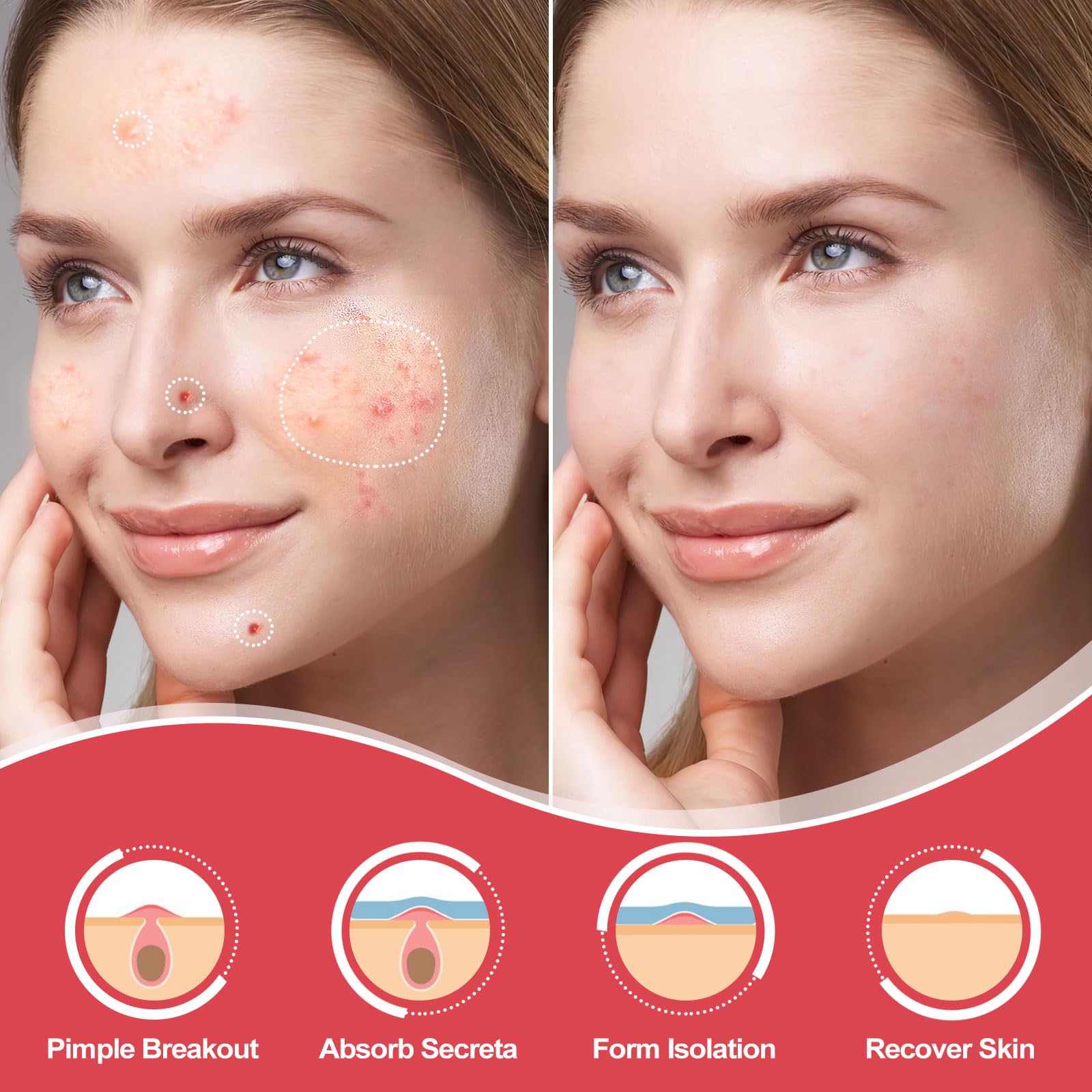 Close up of twelve millimeter and eight millimeter translucent zit stickers on sheet.