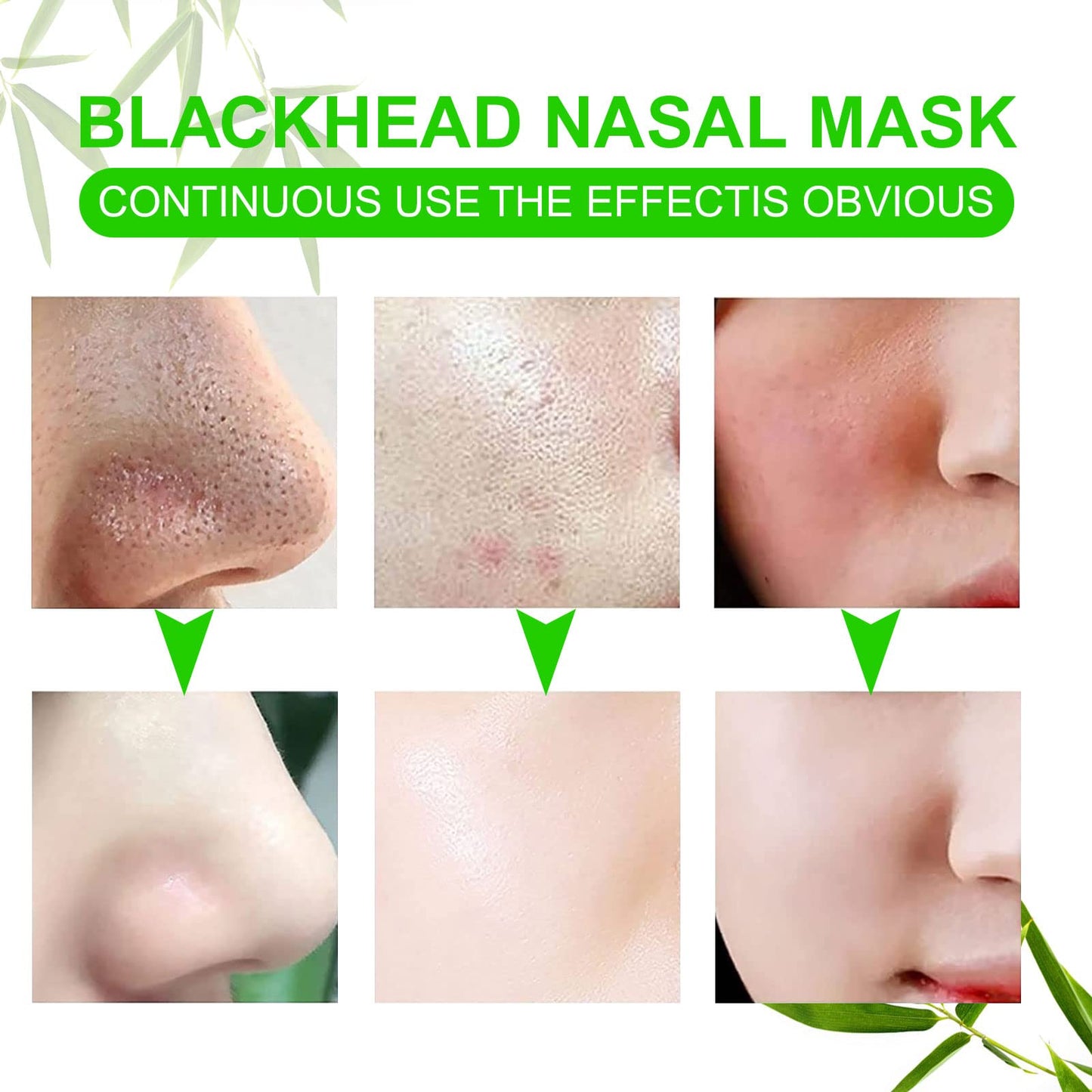 JWBVCTCR blackhead removal strips stack for skincare routine
