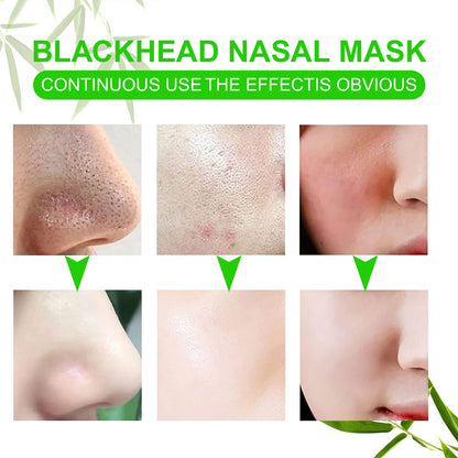 JWBVCTCR blackhead removal strips stack for skincare routine
