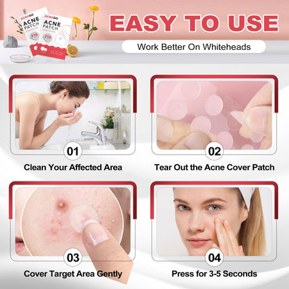 Medical grade fluid absorbing acne spot stickers showing an invisible finish.