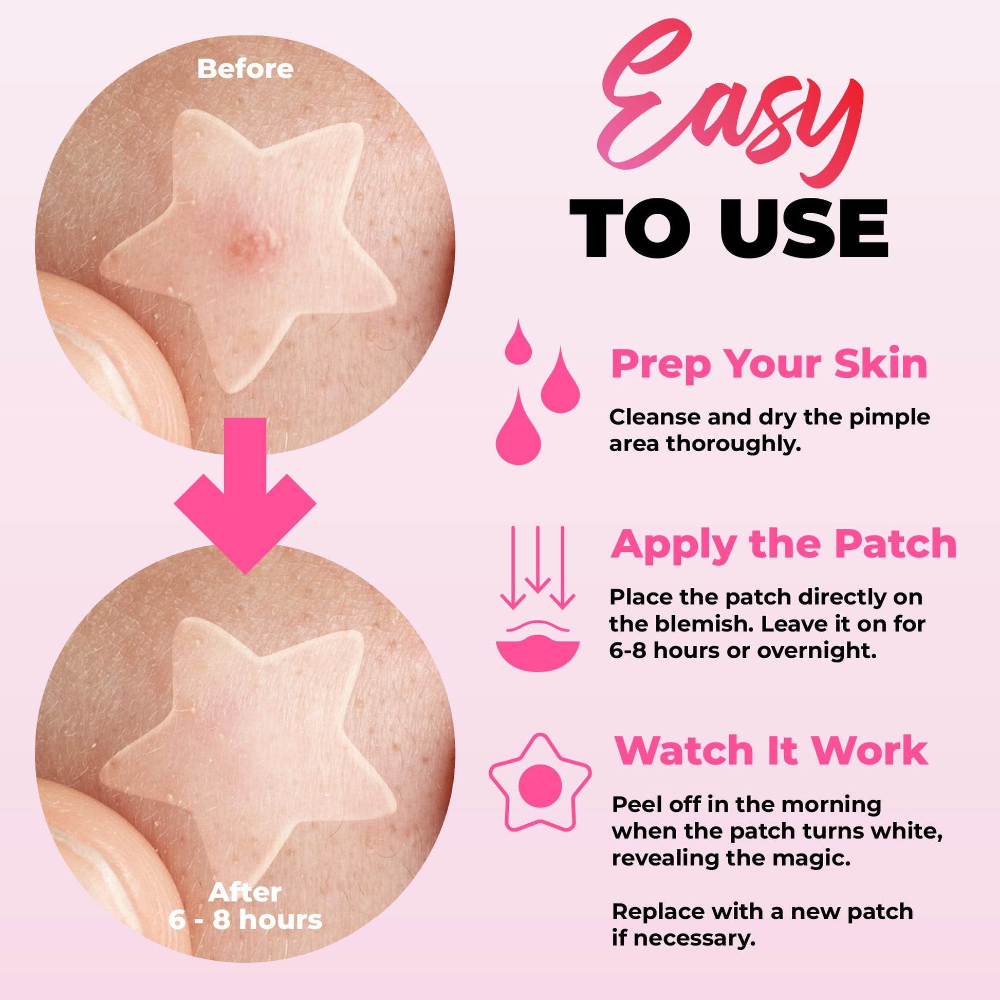 Colorful hydrocolloid blemish stickers in cloud and moon designs for clear skin