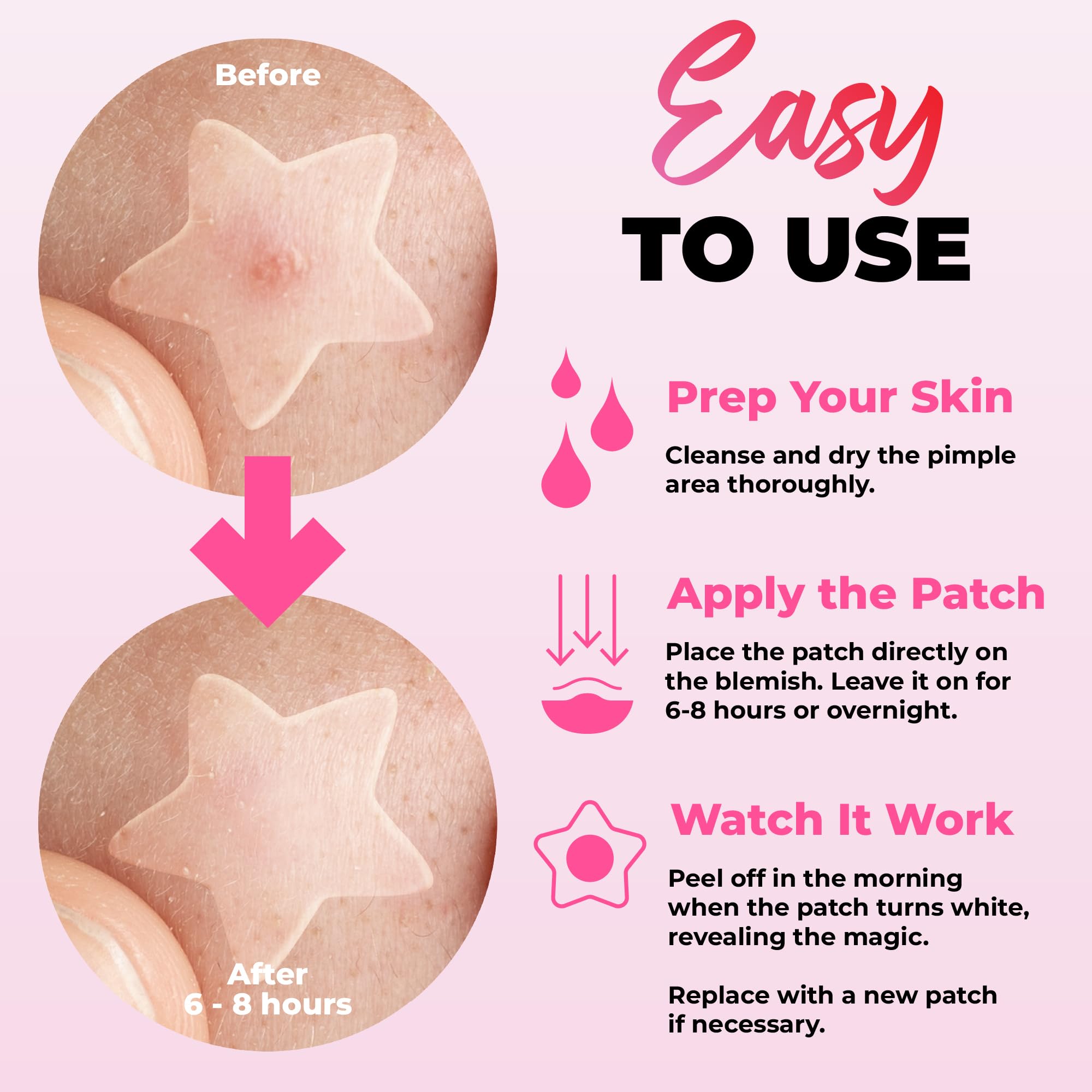 Colorful hydrocolloid blemish stickers in cloud and moon designs for clear skin