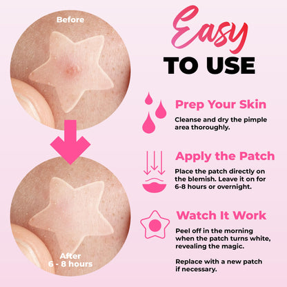 Colorful hydrocolloid blemish stickers in cloud and moon designs for clear skin