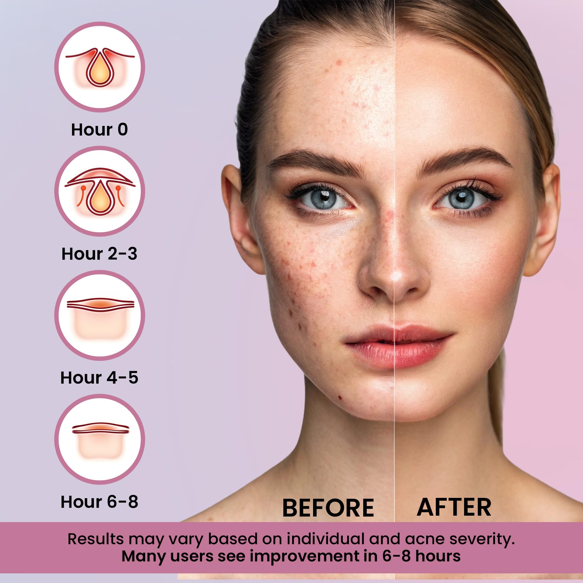 Close up of diverse multi color face stickers designed to protect active breakouts