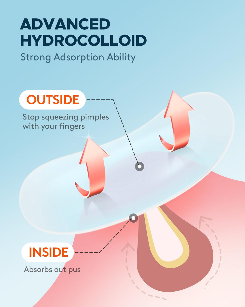 ZATKTK Hydrocolloid patch demonstrating gunk absorption on skin