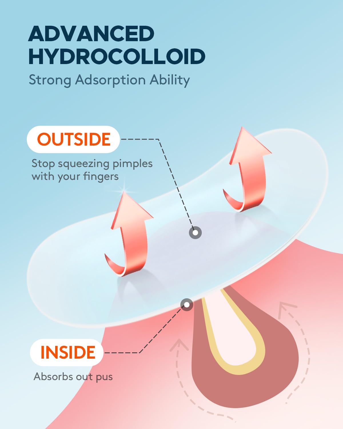 An overview of the four different sizes available in the ZATKTK hydrocolloid patch sheet.