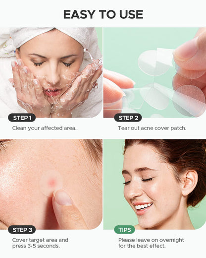 The complete contents of the ZATKTK acne spot treatment package with the included extractor tool.