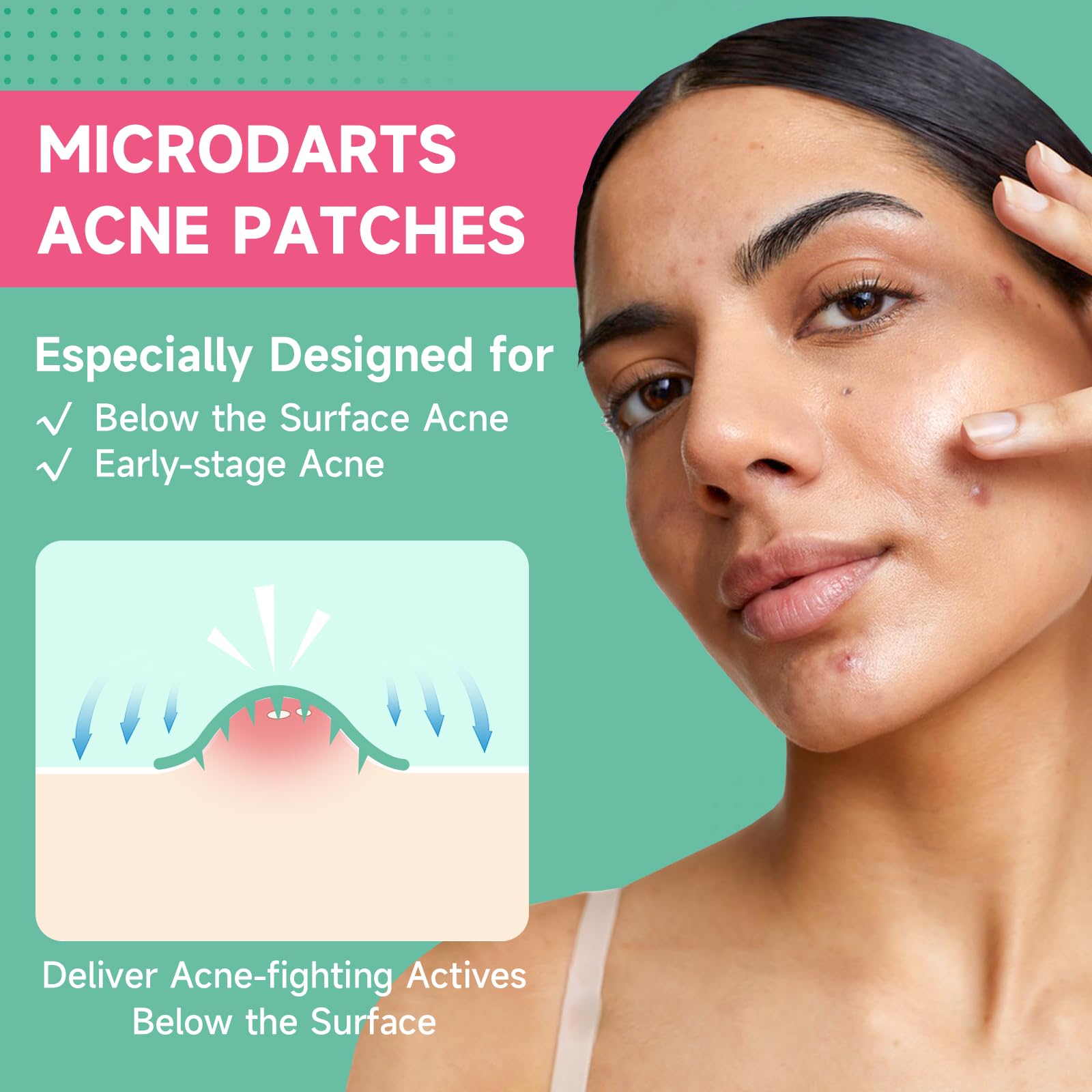 Close up of the self dissolving hydrocolloid patches highlighting the microdart technology texture