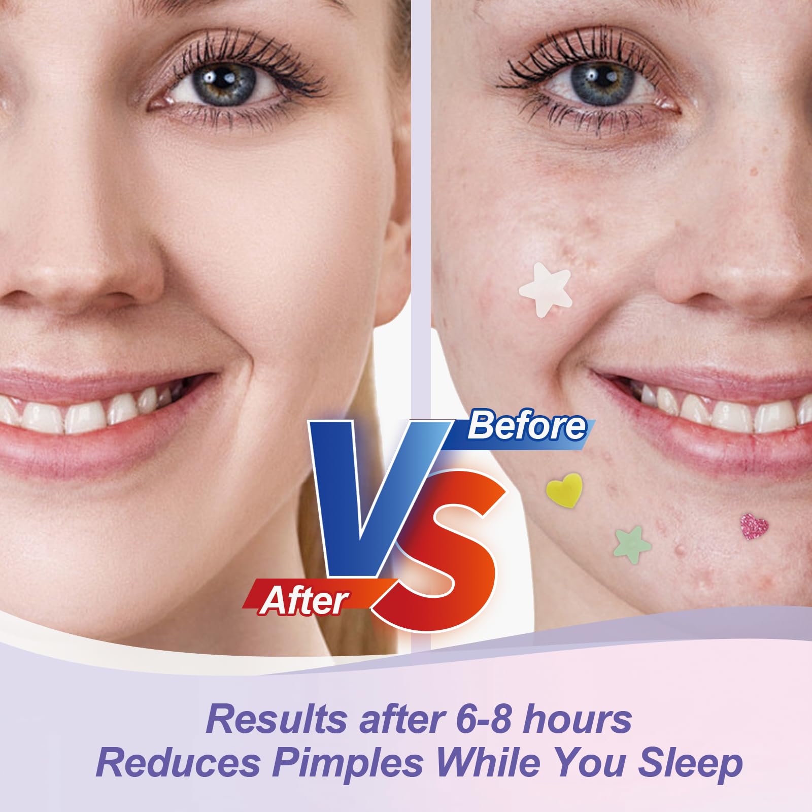 Waterproof hydrocolloid zit covers applied on skin showing protective barrier and adhesion