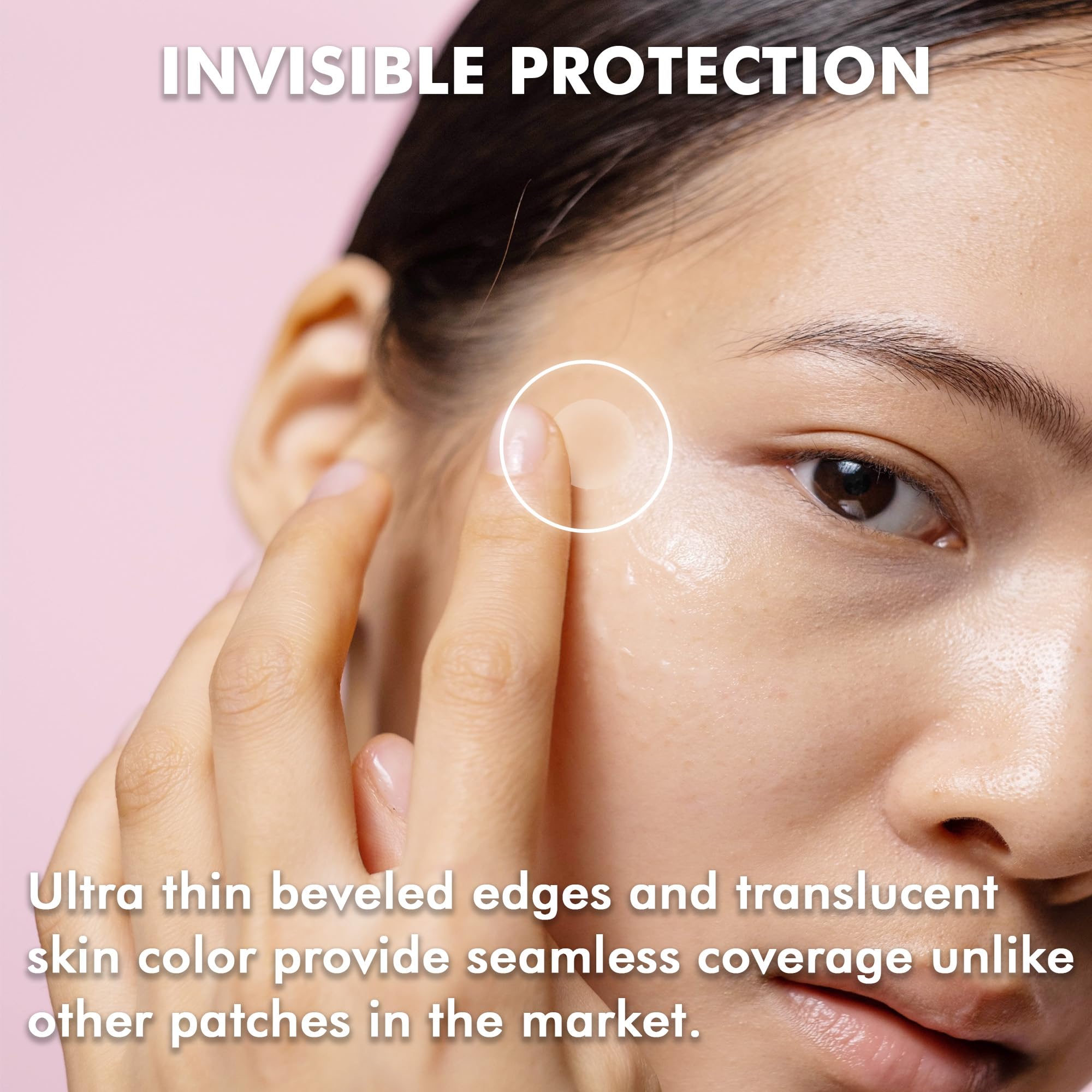 Translucent matte hydrocolloid spot cover applied on a facial blemish to demonstrate invisible protection