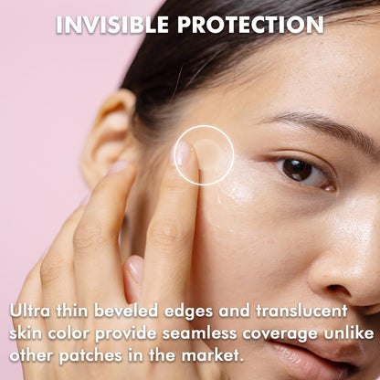 Translucent matte hydrocolloid spot cover applied on a facial blemish to demonstrate invisible protection