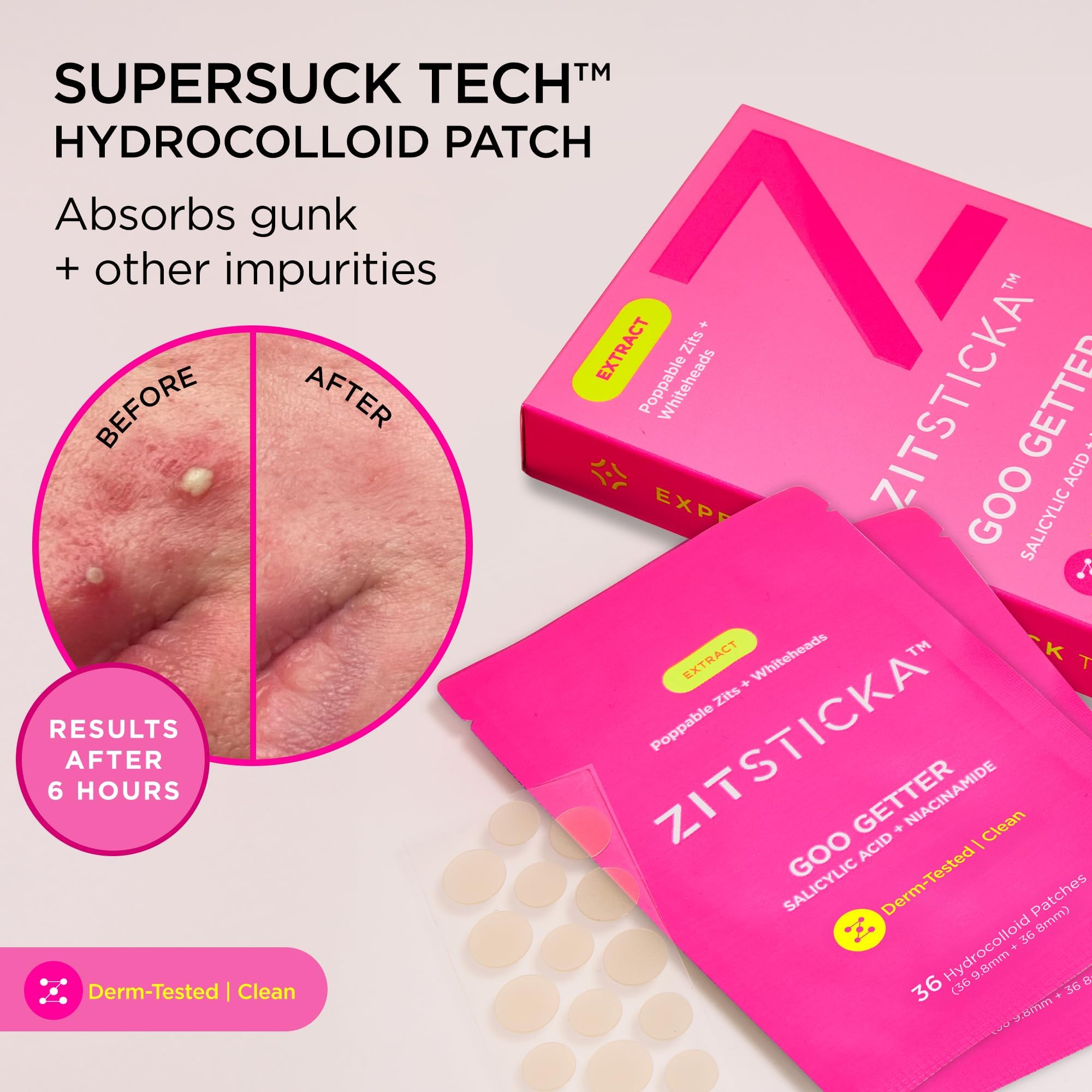 Close up view of ZitSticka hydrocolloid patches showing the translucent round spot stickers designed for face and body breakouts