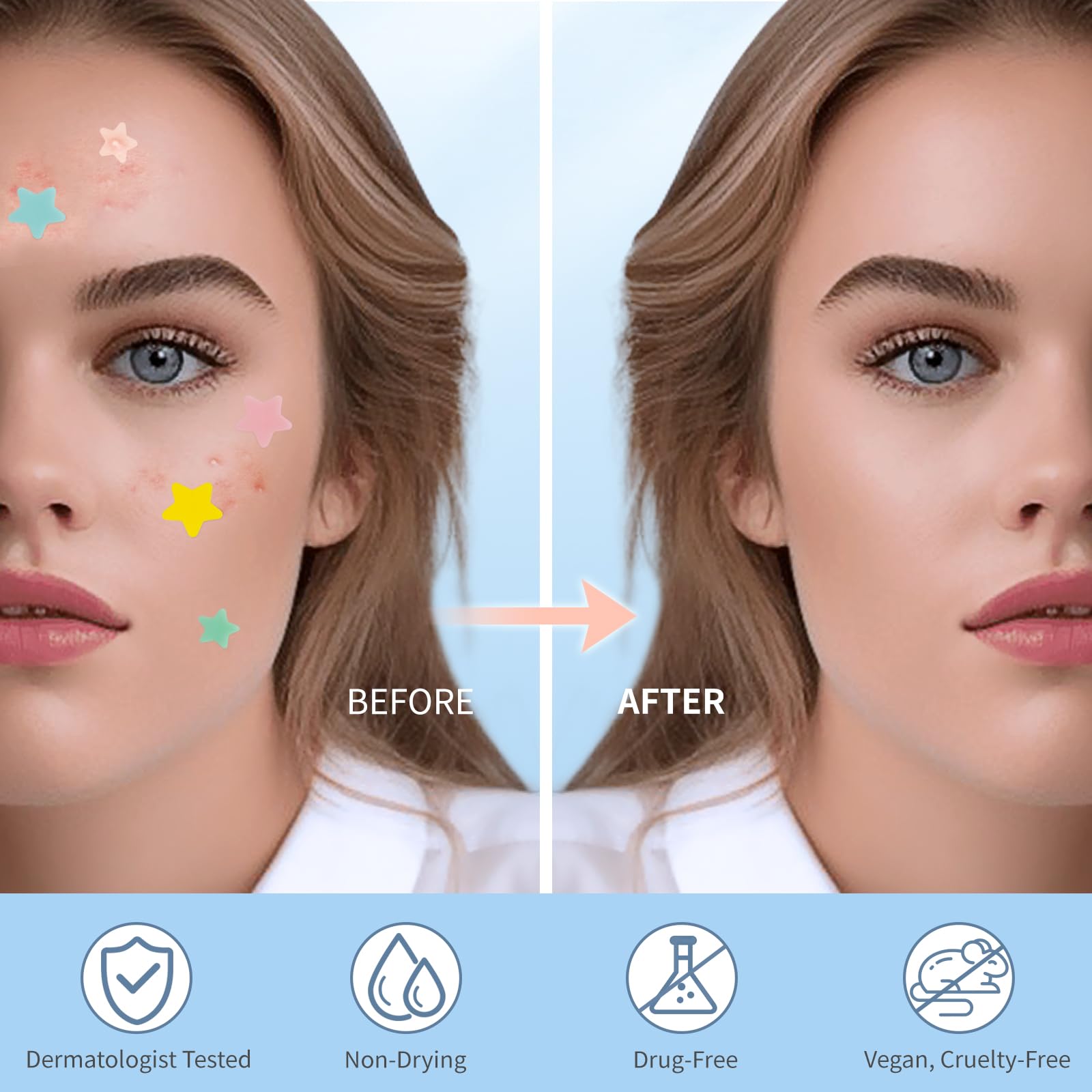 Four different sizes of QUSTERE star zit covers highlighting eight millimeter to fourteen millimeter options
